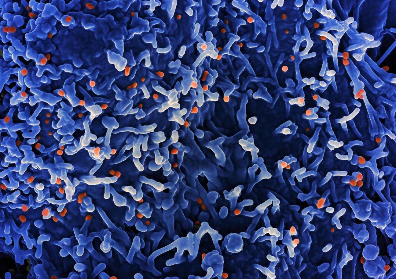 Colorized scanning electron micrograph of mpox virus (orange) on the surface of infected VERO E6 cells (blue). Image captured at the NIAID Integrated Research Facility (IRF) in Fort Detrick, Maryland.